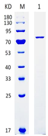 15% SDS-PAGE analysis profiles of purified VP2 (CBB stained).